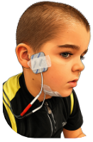 Orofaciální stimulace